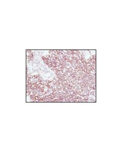 Cell Signaling Beta-Catenin (6b3) Rabbit mAb