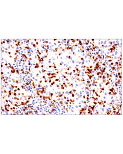 Cell Signaling Cd103/Itgae (Ep206) Rabbit mAb