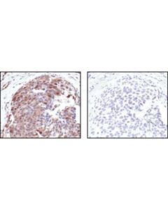 Cell Signaling Phospho-(Ser/Thr) Akt Substrate Antibody