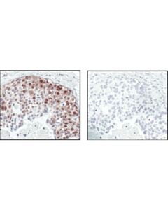 Cell Signaling Phospho-Akt Substrate (Rxxs*/T*) (110b7e) Rabbit mAb