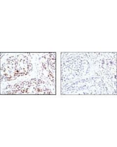 Cell Signaling Phospho-(Ser) Kinase Substrate Antibody Sampler Kit