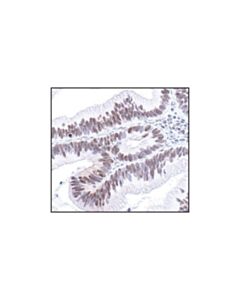 Cell Signaling Phospho-(Ser/Thr) Pka Substrate Antibody