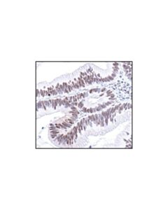 Cell Signaling Phospho-(Ser/Thr) Pka Substrate Antibody