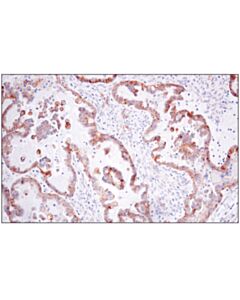 Cell Signaling Cd151 (E4i9j) Xp Rabbit mAb