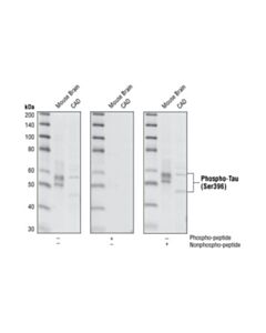Cell Signaling Phospho-Tau (Ser396) (Phf13) Mouse mAb