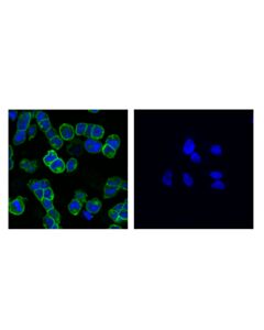 Cell Signaling Dll4 (D7n3h) Rabbit mAb