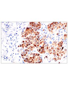 Cell Signaling Cps1/Hep Par-1 (Och1e5) Mouse mAb (Clone Previously Known As Hepatocyte Specific Antigen)