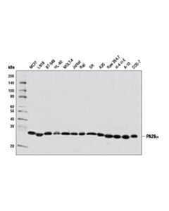 Cell Signaling Pa28alpha (D1c10) Rabbit mAb