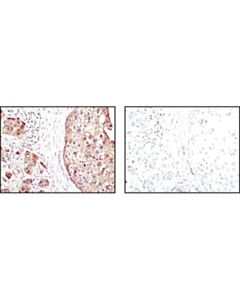 Cell Signaling 4e-Bp1 (53h11) Rabbit mAb