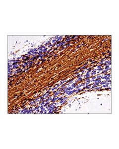 Cell Signaling Mog (E5k6t) Xp Rabbit mAb