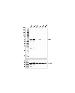 Cell Signaling IRF-5 (E9I4Z) Rabbit mAb 20 uL