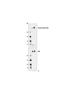 Cell Signaling Double Strand Breaks (Dsb) Repair Antibody Sampler Kit
