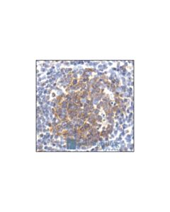 Cell Signaling Caspase-3 Antibody