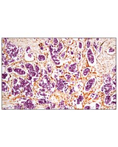 Cell Signaling Signalstain Vivid Purple Peroxidase Substrate Kit