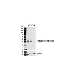 Cell Signaling TACI/TNFRSF13B/CD267 (E1D1P) Rabbit mAb 20 uL