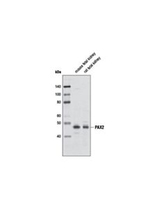Cell Signaling Pax2 Antibody