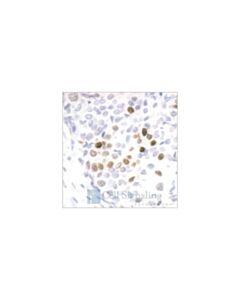 Cell Signaling Phospho-Histone H3 (Ser10) Antibody