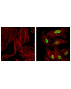 Cell Signaling Atf-4 (E4q4e) Mouse mAb