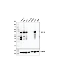 Cell Signaling Slp-76 (E4n7e) Rabbit mAb (BSA And Azide Free)