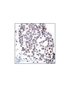 Cell Signaling Acetyl- And Phospho-Histone H3 (Lys9/Ser10) Antibody
