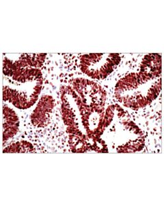 Cell Signaling Tri-Methyl-Histone H3 (Lys27) (C36b11) Rabbit mAb