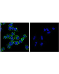 Cell Signaling Dap12 (E7u7t) Rabbit mAb