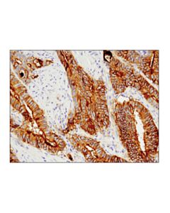 Cell Signaling Tissue Factor/Cd142 (E9m6t) Xp Rabbit mAb