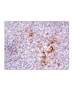 Cell Signaling Cd11c (D1v9y) Rabbit mAb