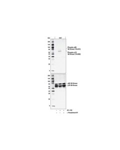 Cell Signaling Phospho-P70 S6 Kinase (Thr389) (D5u1o) Rabbit mAb