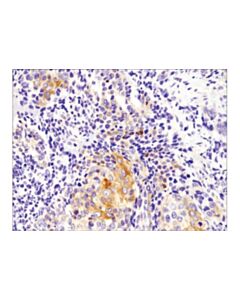 Cell Signaling Foxo1 (D8t1s) Mouse mAb