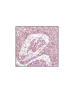 Cell Signaling Pp2a Antibody Sampler Kit