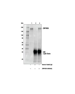 Cell Signaling Zmynd8 Antibody