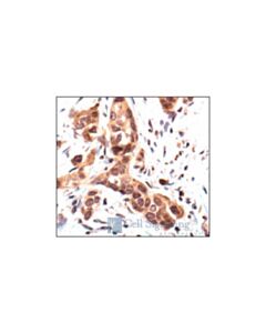Cell Signaling P38 Mapk Isoform Activation Antibody Sampler Kit