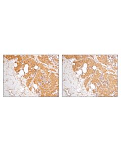 Cell Signaling Shp-2 Antibody Sampler Kit