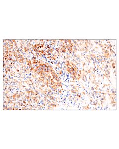 Cell Signaling Hla-Dra (E9r2q) Xp Rabbit mAb