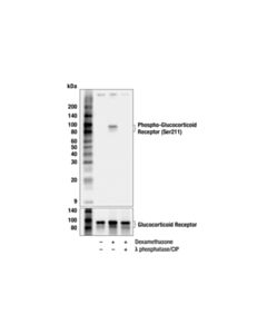 Cell Signaling PhosphoPlus® Glucocorticoid Receptor (Ser211) Antibody Duet; 1 Kit