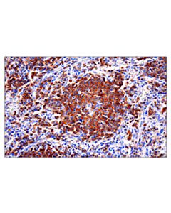 Cell Signaling Cd22 (E7l6z) Xp Rabbit mAb