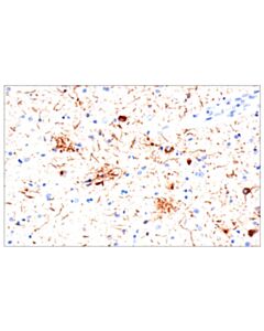 Cell Signaling Phospho-Tau (Thr205) (E3e3b) Mouse mAb (BSA And Azide Free)