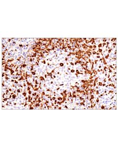 Cell Signaling MSR1 (E7P6W) Rabbit mAb 20 uL