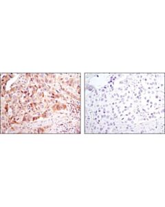 Cell Signaling Pro-Apoptosis Bcl-2 Family Antibody Sampler Kit Ii