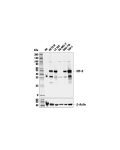 Cell Signaling Irf-8 (E8x4k) Rabbit mAb