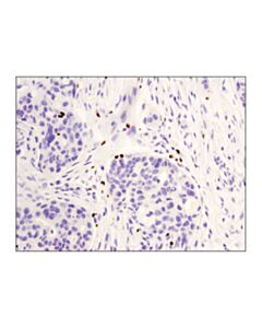 Cell Signaling Foxp3 (D2w8e) Rabbit mAb (Ihc Specific)