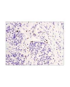 Cell Signaling Foxp3 (D2w8e™) Rabbit mAb