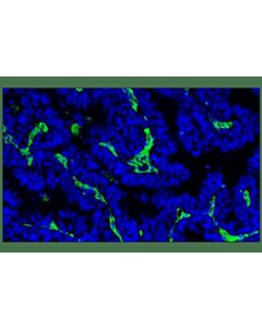 Cell Signaling Vimentin (D21H3) XP® Rabbit mAb (Alexa Fluor® 488 Conjugate); 20 µl