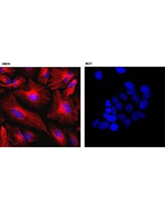 Cell Signaling Vimentin (D21h3) Xp Rabbit mAb (Alexa Fluor 555 Conjugate)