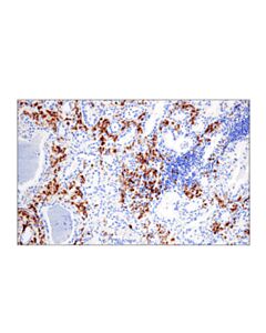 Cell Signaling Cracc/Slamf7/Cd319 (E5c4m) Rabbit mAb