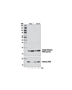 Cell Signaling Acetyl-Histone H2b (Lys12) (D7h4) Rabbit mAb