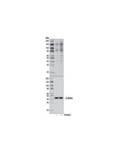 Cell Signaling O-Glcnac (Ctd110.6) Mouse mAb