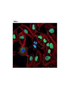 Cell Signaling Ddx5 (D15e10) Xp Rabbit mAb