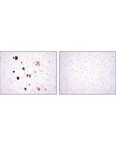 Cell Signaling Beta-Amyloid (D12b2) Rabbit mAb